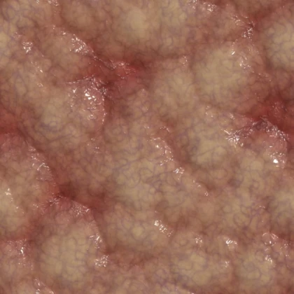 Flesh and Goop texture