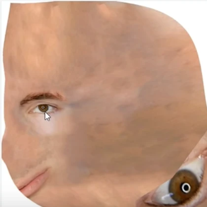 ALBERT